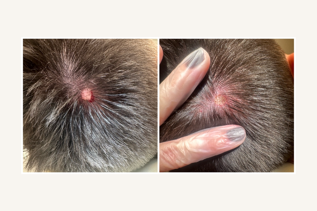 Laser removal of moles